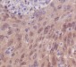 Anti-IRF3 Rabbit Monoclonal Antibody